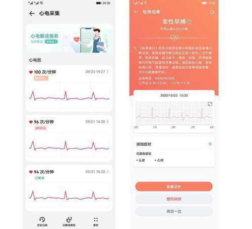 华为gt2如何添加股票
